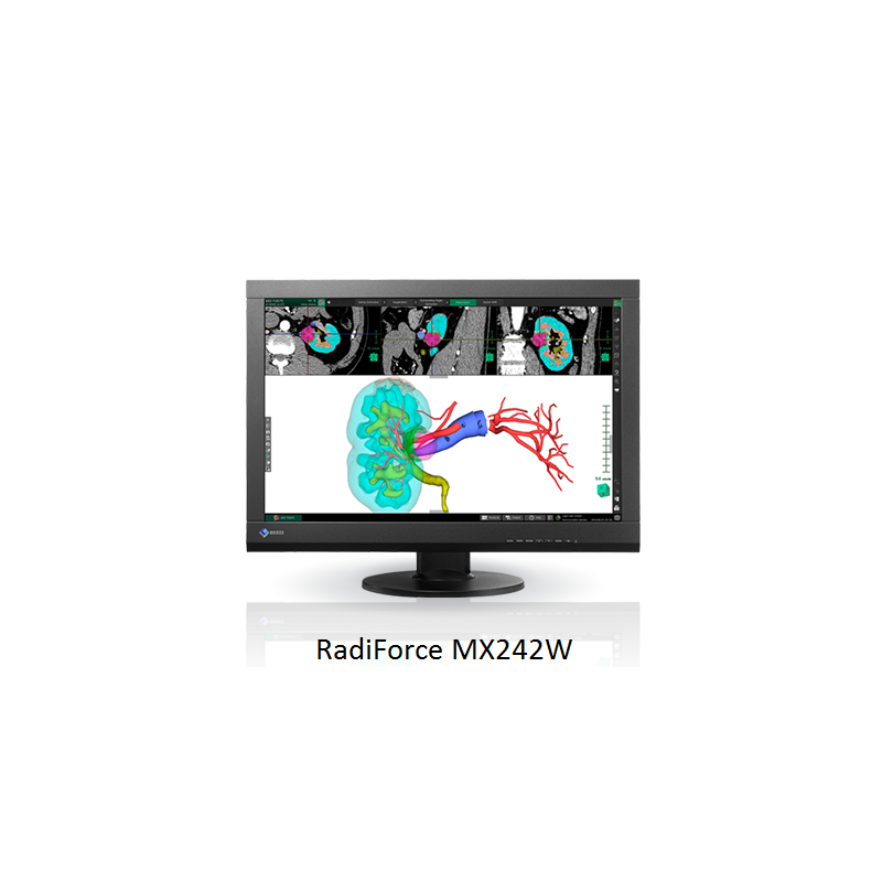 Ecran EIZO RadiForce MX242 - Demonstration JFR